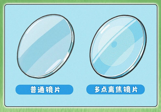 科普|都戴离焦镜，为什么效果不一样？