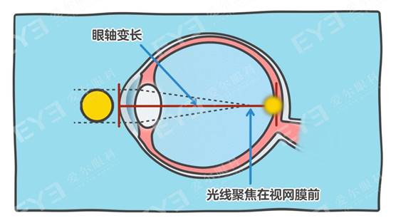 科普 | 寒假来了，别让你家孩子近视度数蹭蹭涨