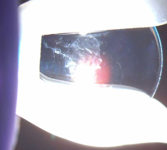 科普 | 泉州爱尔眼科医院温馨提醒：OK镜超期配戴隐患大